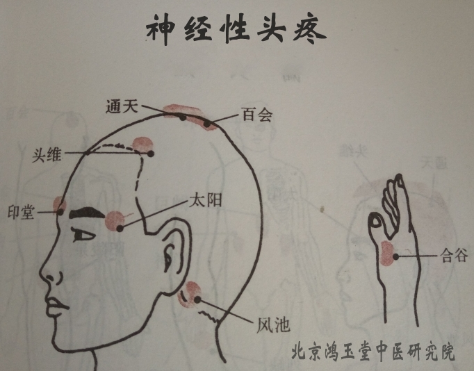 鸿玉堂六合针灸，皮下针，抖针培训