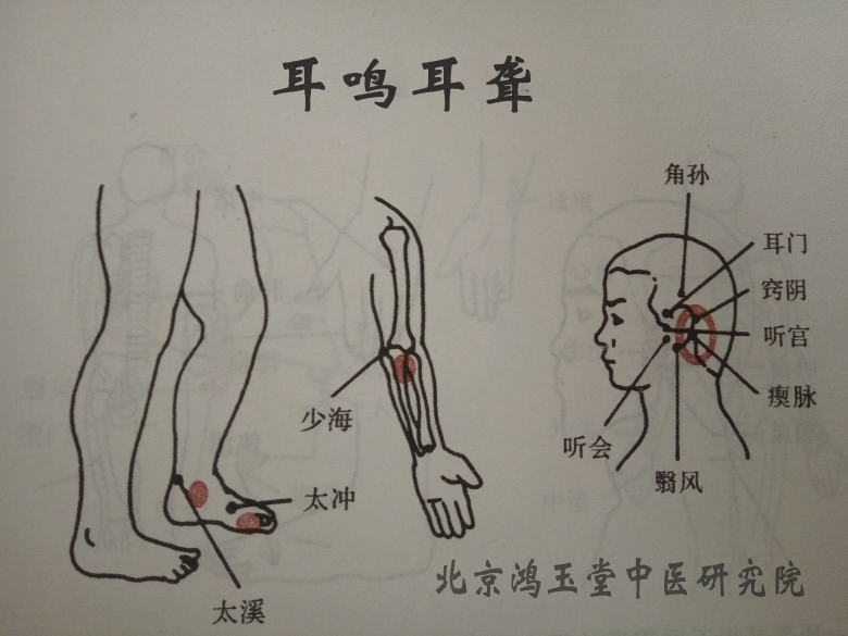 特色灸疗和无痛六合针灸技术公开课在北京举办