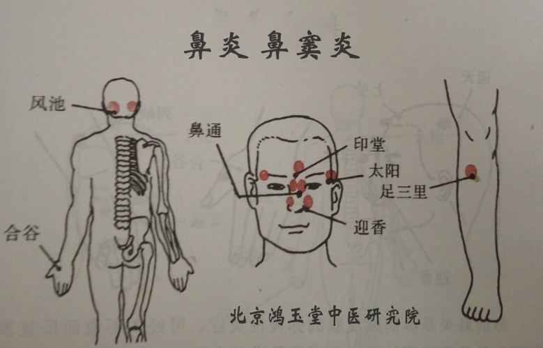 特色灸疗和无痛六合针灸技术公开课在北京举办