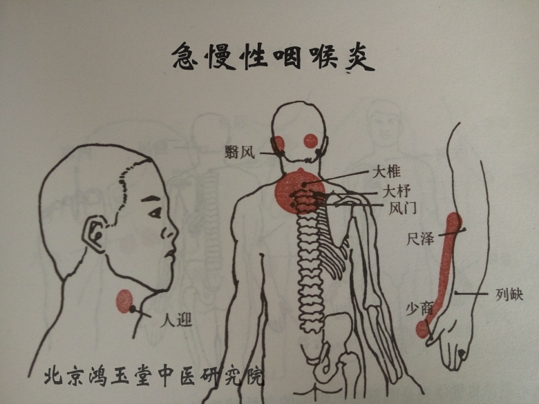 特色灸疗和无痛六合针灸技术公开课在北京举办