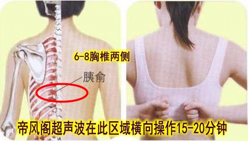 超声波治疗糖尿病 超声波治疗糖尿病