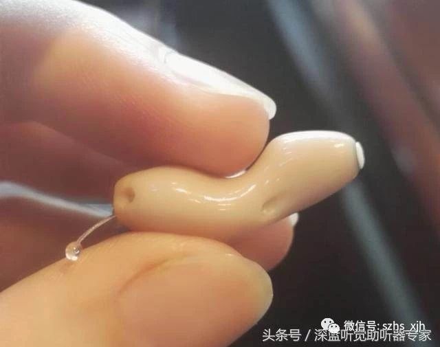 分泌性中耳炎和突发性耳聋的鉴别-上海助听器
