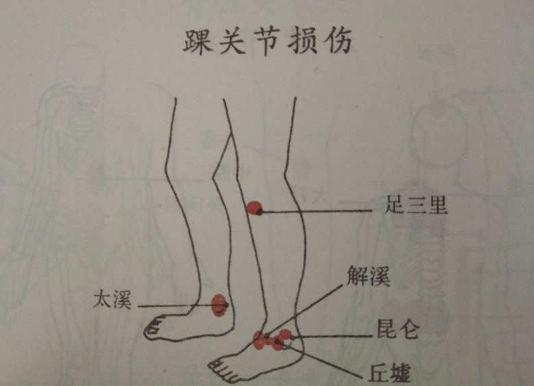 照图刮拭顺序:1,小腿前侧2,足背踝3,足外踝4