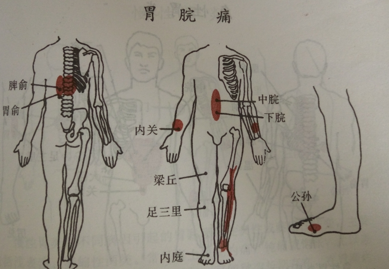 为胃之和穴,配内关,梁丘有和胃理中,行气止痛之功;脾俞,胃俞,内庭